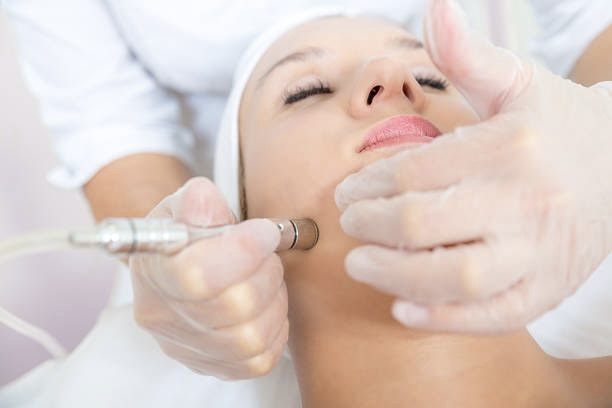 Diamond Glow Microdermabrasion Treatment Areas