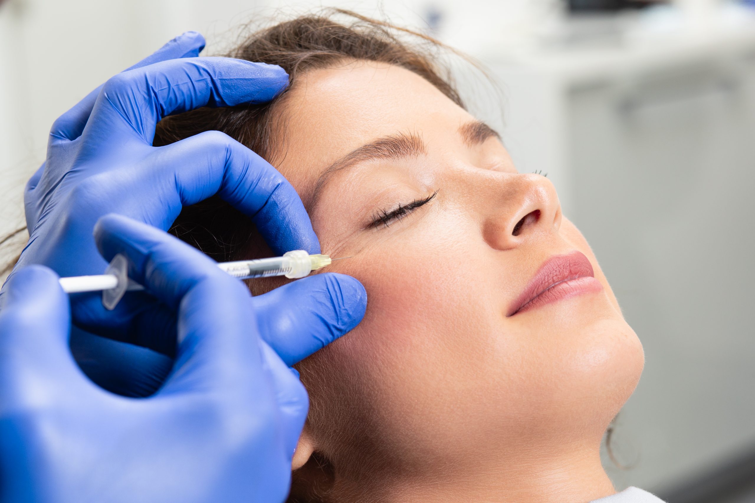 Injectable Wrinkle Relaxers Crows Feet