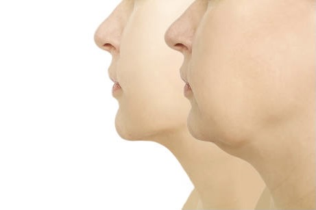 lower face and neck