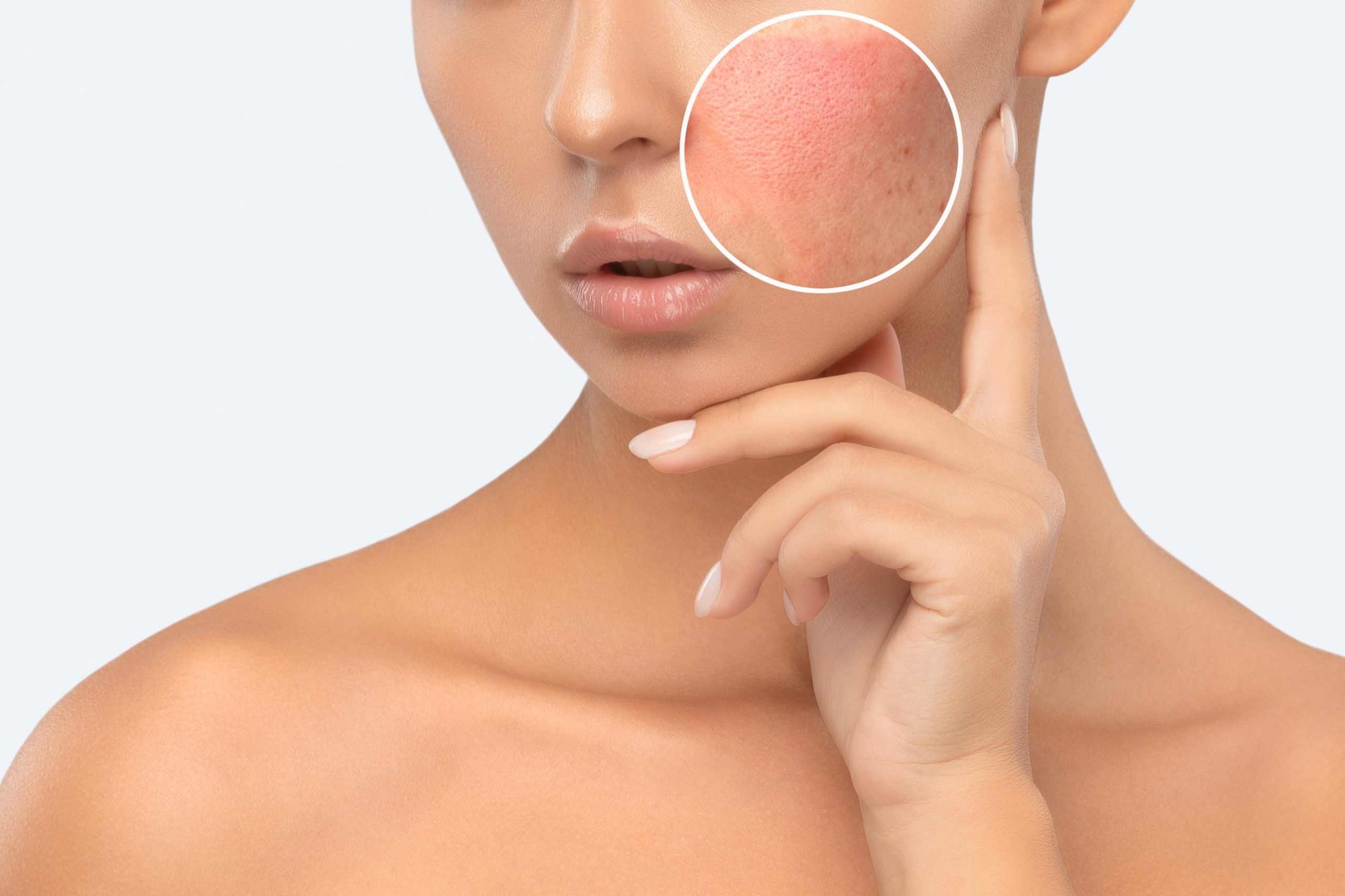 MicroLaser Peel For Resurfacing Beverly Hills Spa26